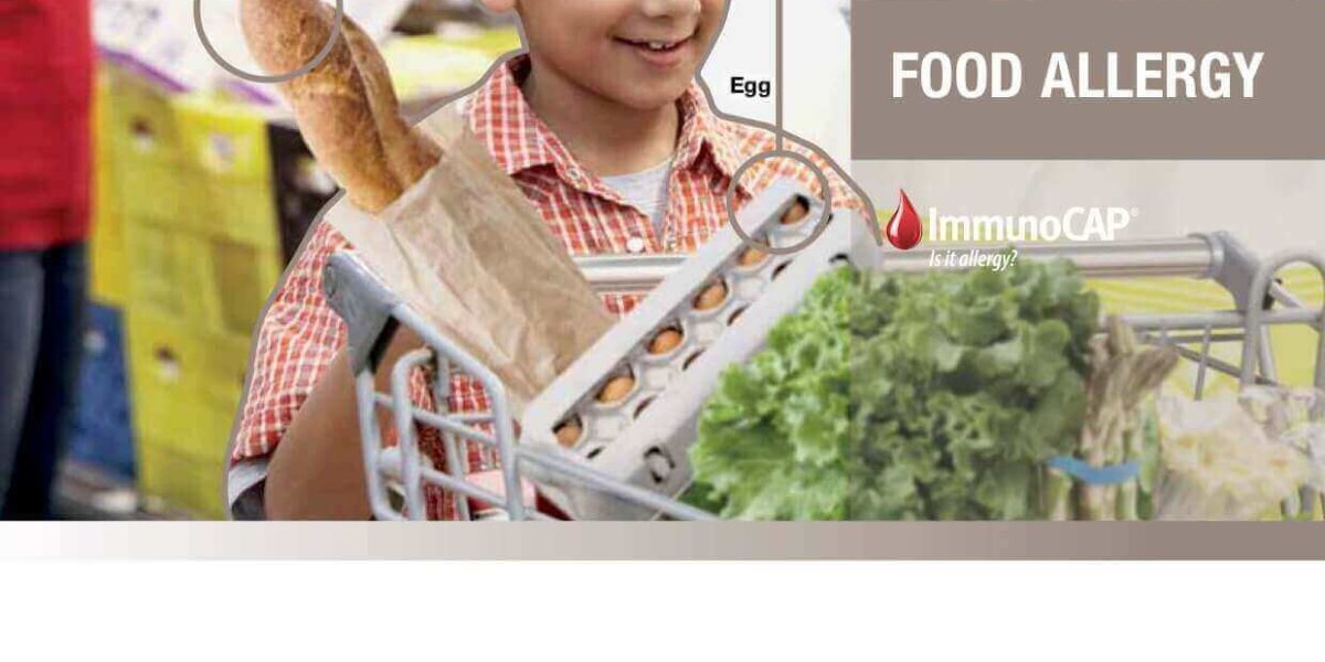 Alergia a la comida – ImmunoCAP